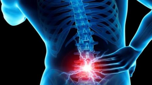 معلومات عن آلام أسفل الظهر وكيف يمكنك الشفاء منه سريعا