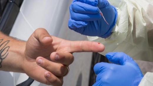 الرجال ينتجون أجساما مضادة لـ”كوفيد-19″ أكثر من النساء