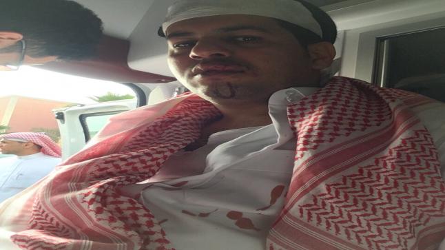 “جمال سنان” اليمني الذي اعتدى عليه الأمير السعودي يظهر في فيديو جديد يناشد الملك سلمان